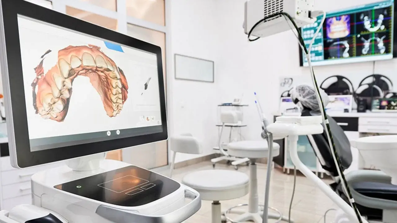 Scanner 3D iTero